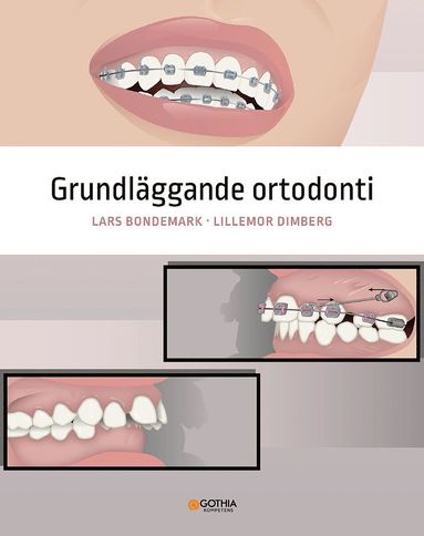 Grundl�ggande ortodonti (storpocket)