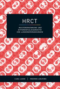 HRCT - Mustererkennung und Differentialdiagnostik von Lungenerkrankungen (häftad)