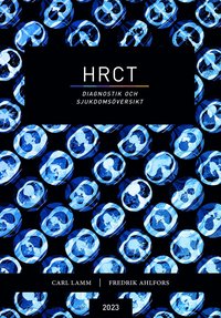 HRCT : diagnostik och sjukdomsöversikt (häftad)