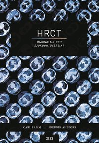 HRCT ? diagnostik och sjukdomsöversikt (e-bok)