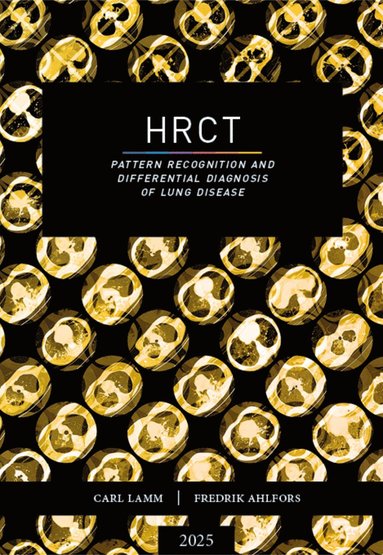 HRCT : pattern recognition and differential diagnosis of lung disease (inbunden)
