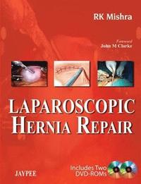 Laparoscopic Hernia Repair (inbunden)