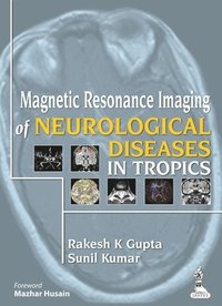 Magnetic Resonance Imaging of Neurological Diseases in Tropics (inbunden)
