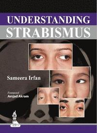 Understanding Strabismus (hftad)
