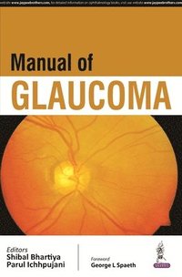 Manual of Glaucoma (häftad)