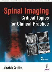 Spinal Imaging: Critical Topics for Clinical Practice (inbunden)