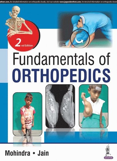 Fundamentals of Orthopedics (häftad)