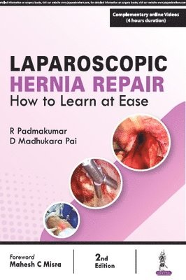 Laparoscopic Hernia Repair R Padmakumar D Madhukara Pai Häftad Bokus