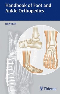 Handbook of Foot and Ankle Orthopedics (e-bok)