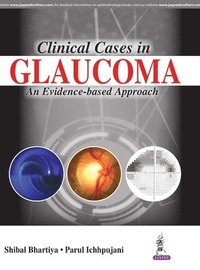 Clinical Cases in Glaucoma (häftad)