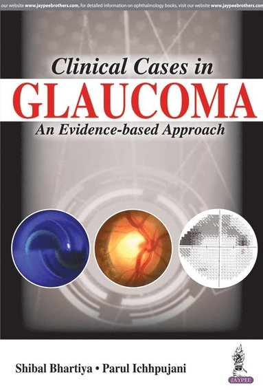Clinical Cases in Glaucoma (hftad)