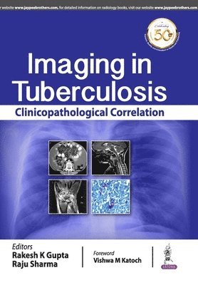 Imaging in Tuberculosis (hftad)