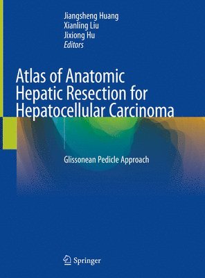 Atlas of Anatomic Hepatic Resection for Hepatocellular Carcinoma (inbunden)