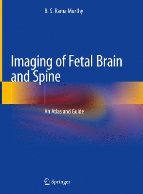 Imaging of Fetal Brain and Spine (inbunden)