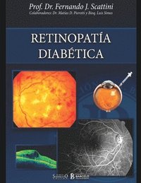 Retinopatia diabetica (häftad)