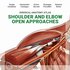 Shoulder and Elbow Open Approaches