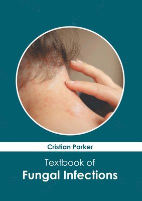 Textbook of Fungal Infections (hftad)