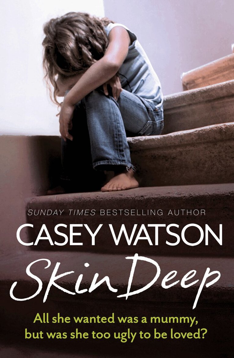 Casey Watson - Skin Deep, E-bok