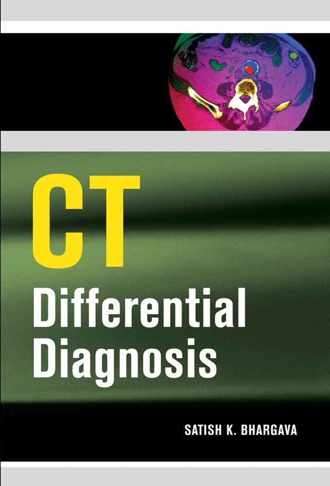 Satish Bhargava - CT Differential Diagnosis, Häftad