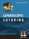 Laparoscopic Suturing