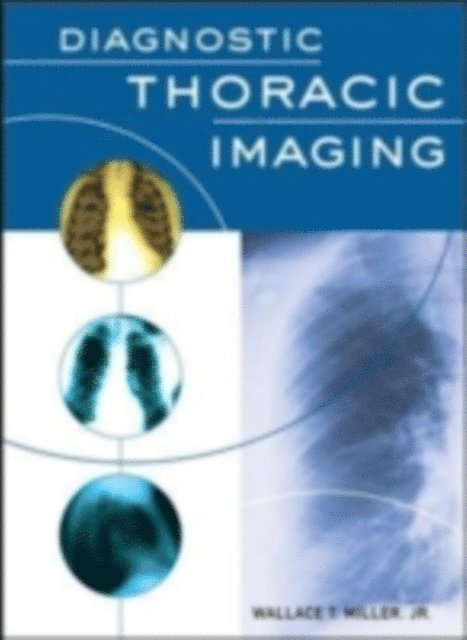 Wallace T. Miller - Diagnostic Thoracic Imaging, E-bok