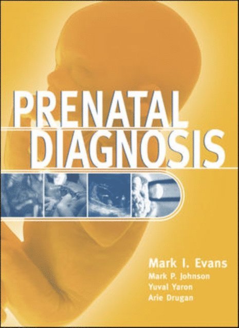 Mark I. Evans - Prenatal Diagnosis, E-bok
