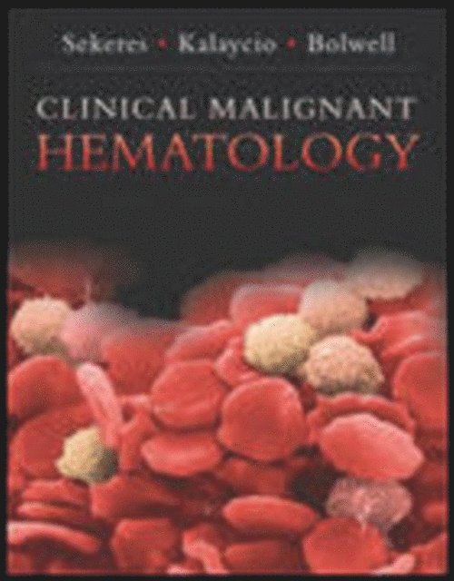 Brian Bolwell, Matt Kalacyio, Mikkael A. Sekeres - Clinical Malignant Hematology, E-bok