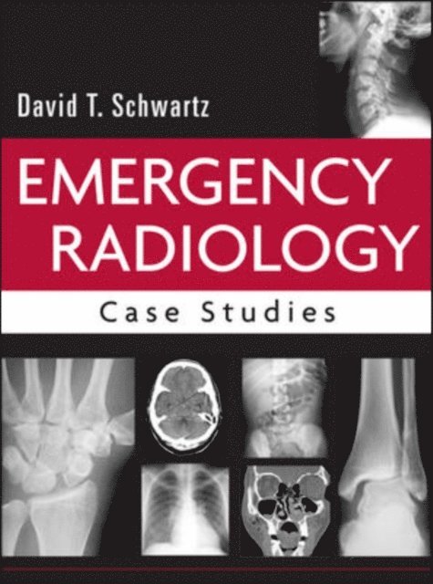 David T. Schwartz - Emergency Radiology: Case Studies, E-bok