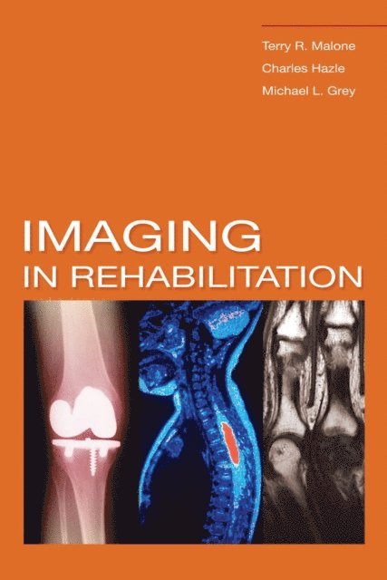 Michael L. Grey, Charles Hazle, Terry R. Malone - Imaging In Rehabilitation, E-bok