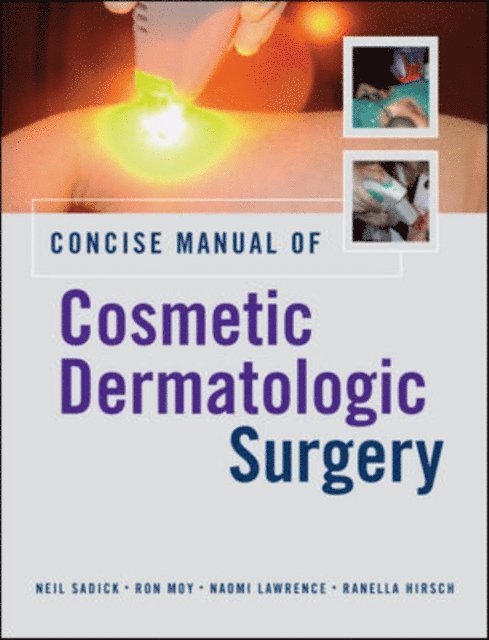 Ranella Hirsch, Naomi Lawrence, Ron Moy, Neil Sadick - Concise Manual of Cosmetic Dermatologic Surgery, E-bok