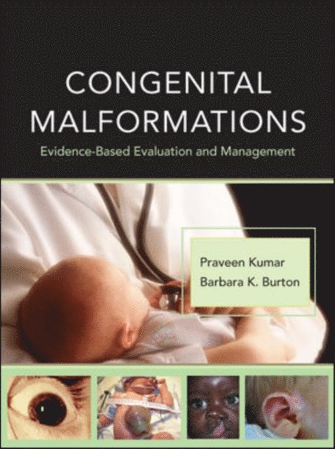 Barbara K. Burton, Praveen Kumar - Congenital Malformations: Evidence-Based Evaluation and Management, E-bok