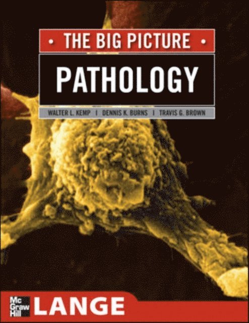 Travis G. Brown, Dennis K. Burns, William Kemp - Pathology: The Big Picture, E-bok