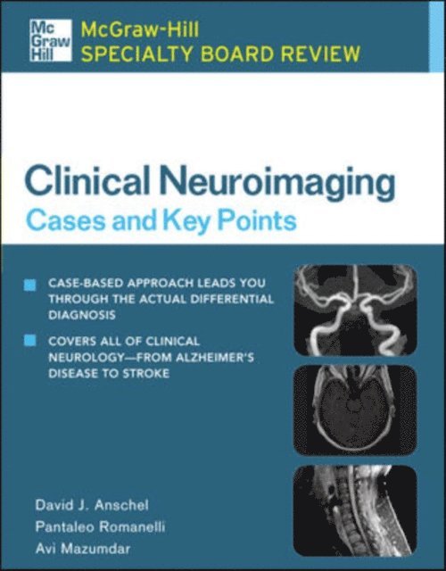 Avi Mazumdar, Pantaleo Romanelli, David J. Anschel - McGraw-Hill Specialty Board Review Clinical Neuroimaging: Cases and Key Points, E-bok