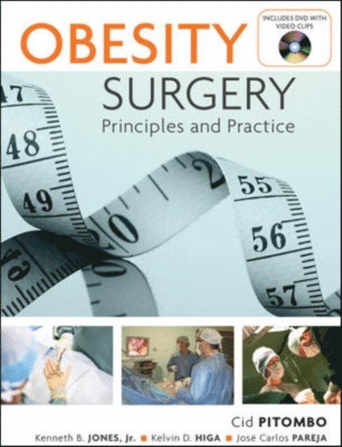 Jose Carlos Pareja, Kelvin Higa, Kenneth Jones, Cid Pitombo - Obesity Surgery: Principles and Practice, E-bok