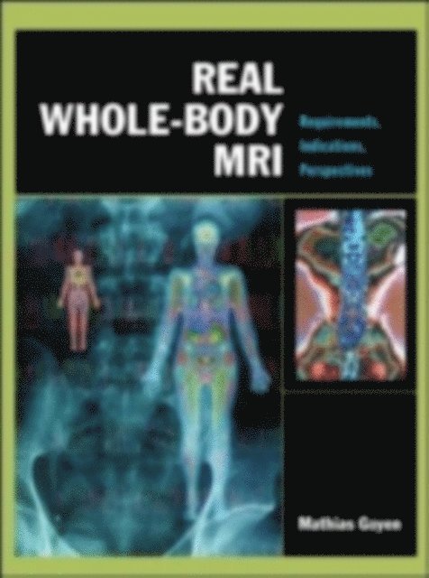 Mathias Goyen - Real Whole-Body MRI: Requirements, Indications, Perspectives, E-bok