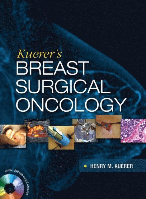 Henry Kuerer - Kuerer's Breast Surgical Oncology, E-bok