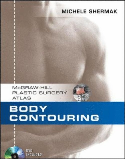 Michele A. Shermak - Body Contouring, E-bok