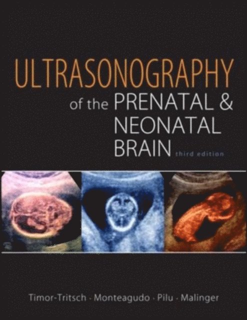 Gustavo Malinger, Gianluigi Pilu, Ana Monteagudo, Ilan Timor-Tritsch - Ultrasonography of the Prenatal Brain, Third Edition, E-bok