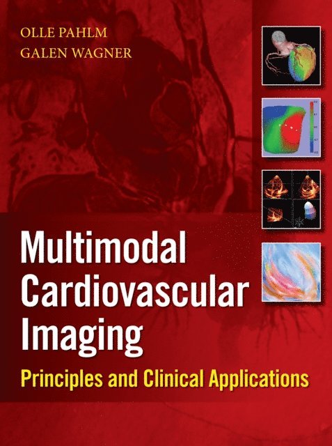 Galen S. Wagner, Olle Pahlm - Multimodal Cardiovascular Imaging: Principles and Clinical Applications, E-bok