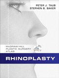 Rhinoplasty