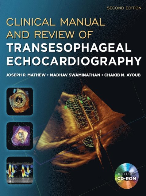 Chakib Ayoub, Madhav Swaminathan, Joseph Mathew - Clinical Manual and Review of Transesophageal Echocardiography, Second Edition, E-bok