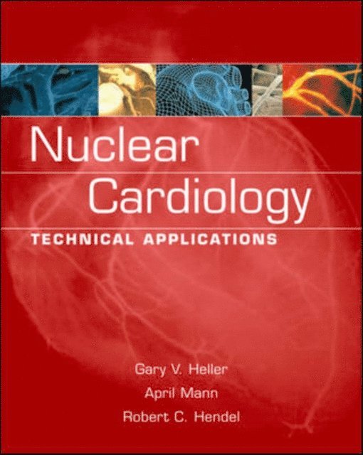Robert C. Hendel, April Mann, Gary V. Heller - Nuclear Cardiology: Technical Applications, E-bok