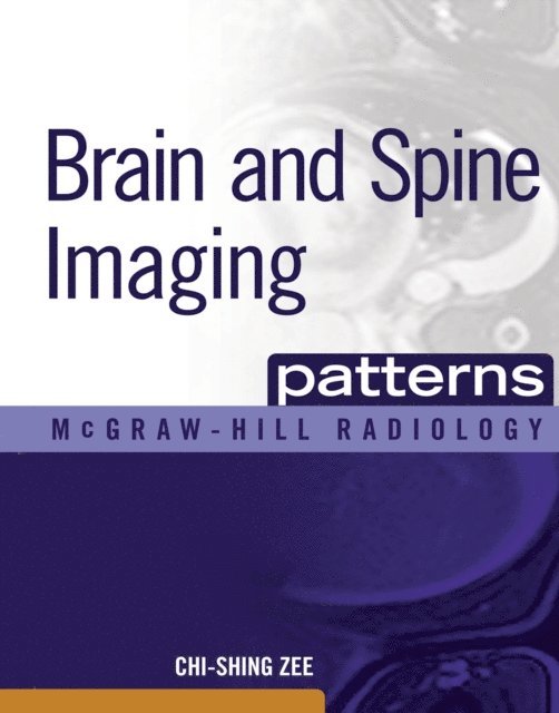 Chi-Shing Zee - Brain and Spine Imaging Patterns, E-bok