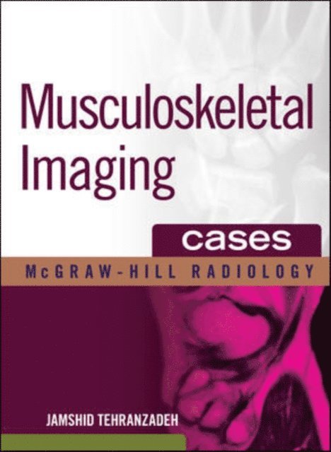 Jamshid Tehranzadeh - Musculoskeletal Imaging Cases, E-bok
