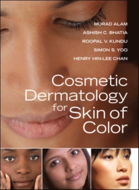 Henry Hin-Lee Chan, Simon S. Yoo, Roopal V. Kundu, Ashish C. Bhatia, Murad Alam - Cosmetic Dermatology for Skin of Color, E-bok