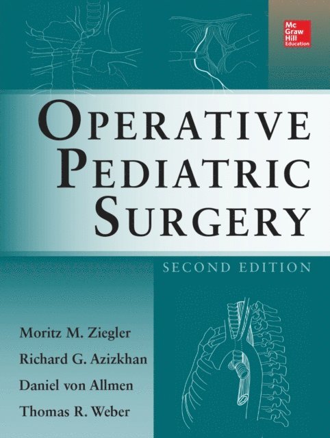 Thomas R. Weber, Daniel von Allmen, Richard G. Azizkhan, Moritz Ziegler - Operative Pediatric Surgery, E-bok