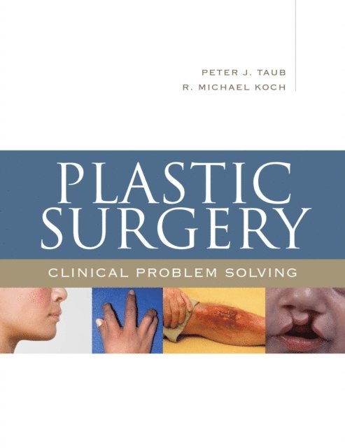 R. Michael Koch, Peter J. Taub - Plastic Surgery: Clinical Problem Solving, E-bok