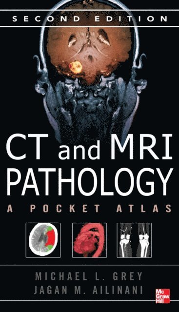 Jagan Mohan Ailinani, Michael L. Grey - CT & MRI Pathology: A Pocket Atlas, Second Edition, E-bok