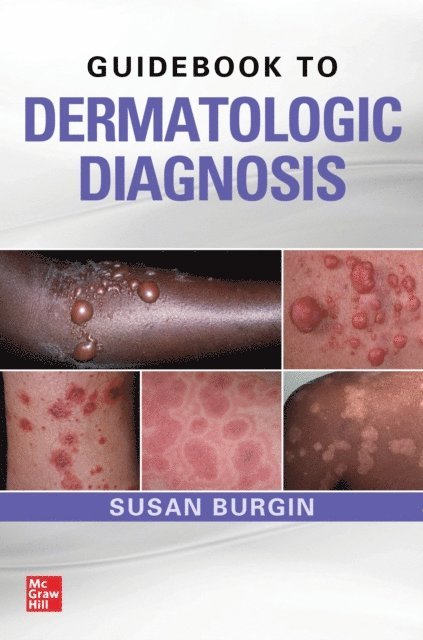 Susan Burgin - Guidebook to Dermatologic Diagnosis, E-bok. Tillgänglighet: Lägg i varukorg