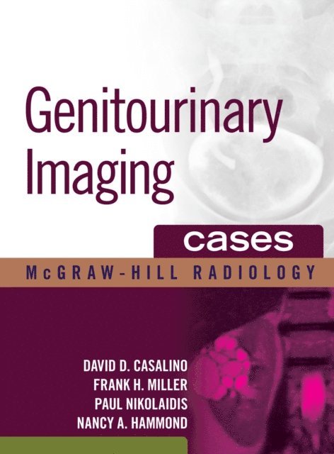 Nancy A. Hammond, Paul Nikolaidis, Frank H. Miller, David D. Casalino - Genitourinary Imaging Cases, E-bok